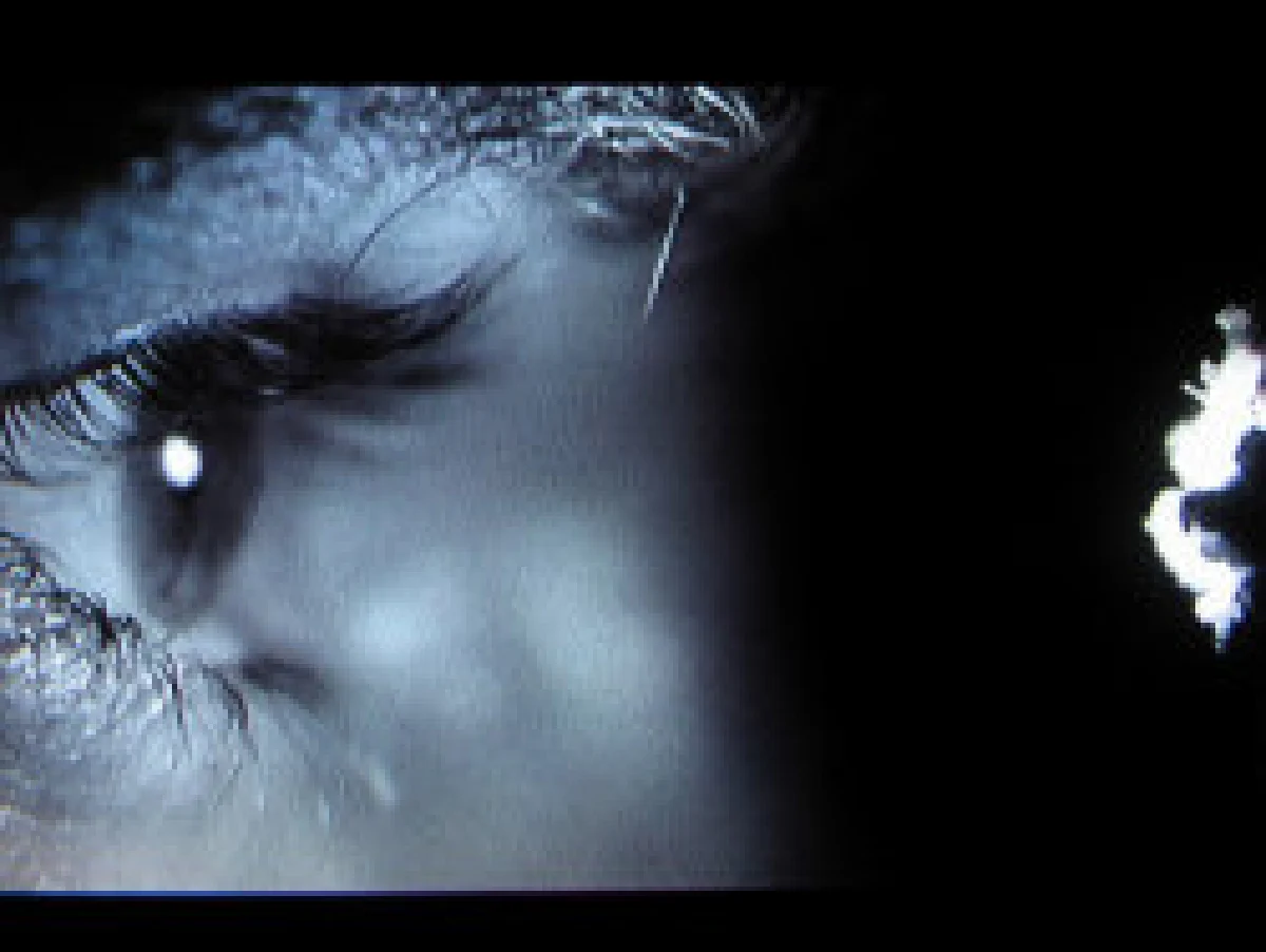 โรคเอเอ็มดี (AMD) ระวังตาบอดเมื่อสูงวัย