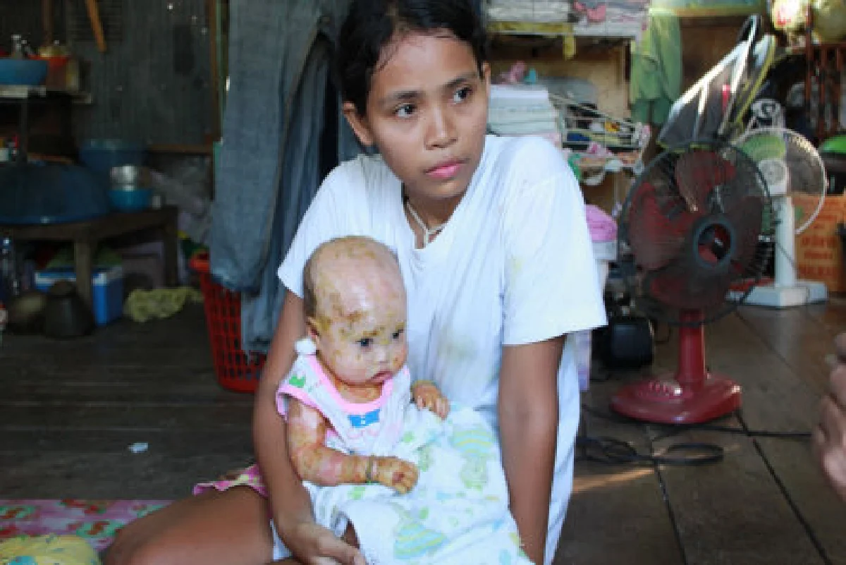 พบน้องดักแด้อีกรายที่ปากน้ำ