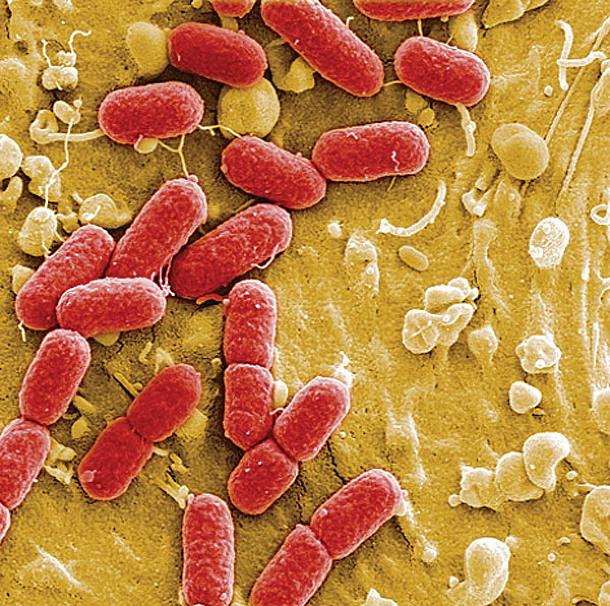 e coli