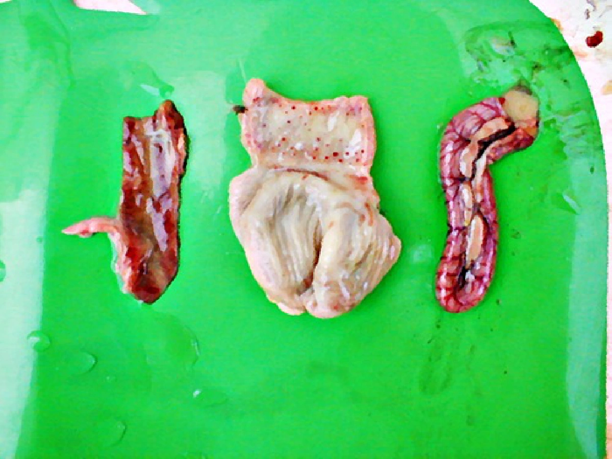 Newcastle's disease