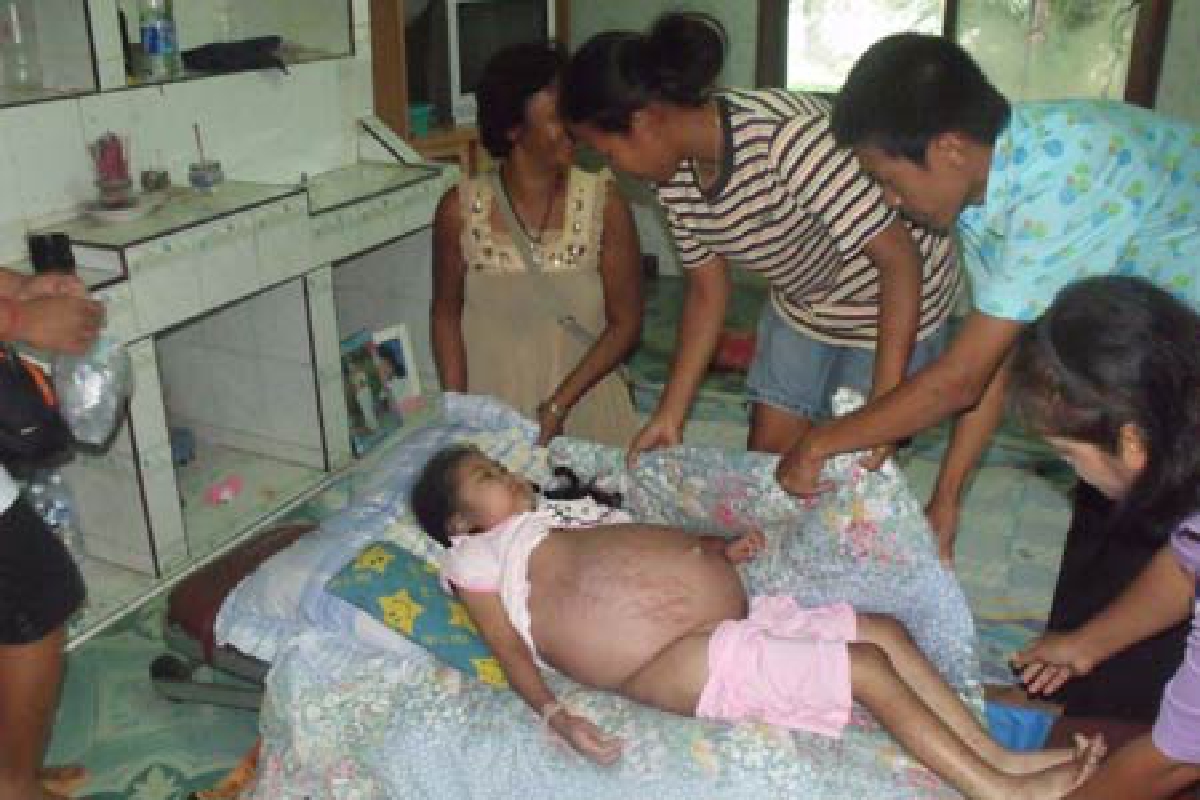 รพ.ชุมพรรับน้องกิ๊ฟป่วยโรคพุงโตรักษา รพ.ชุมพรรับน้องกิ๊ฟป่วยโรคพุงโตรักษา