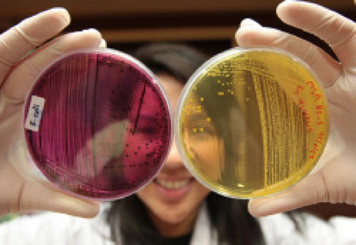 วายร้ายอีโคไล