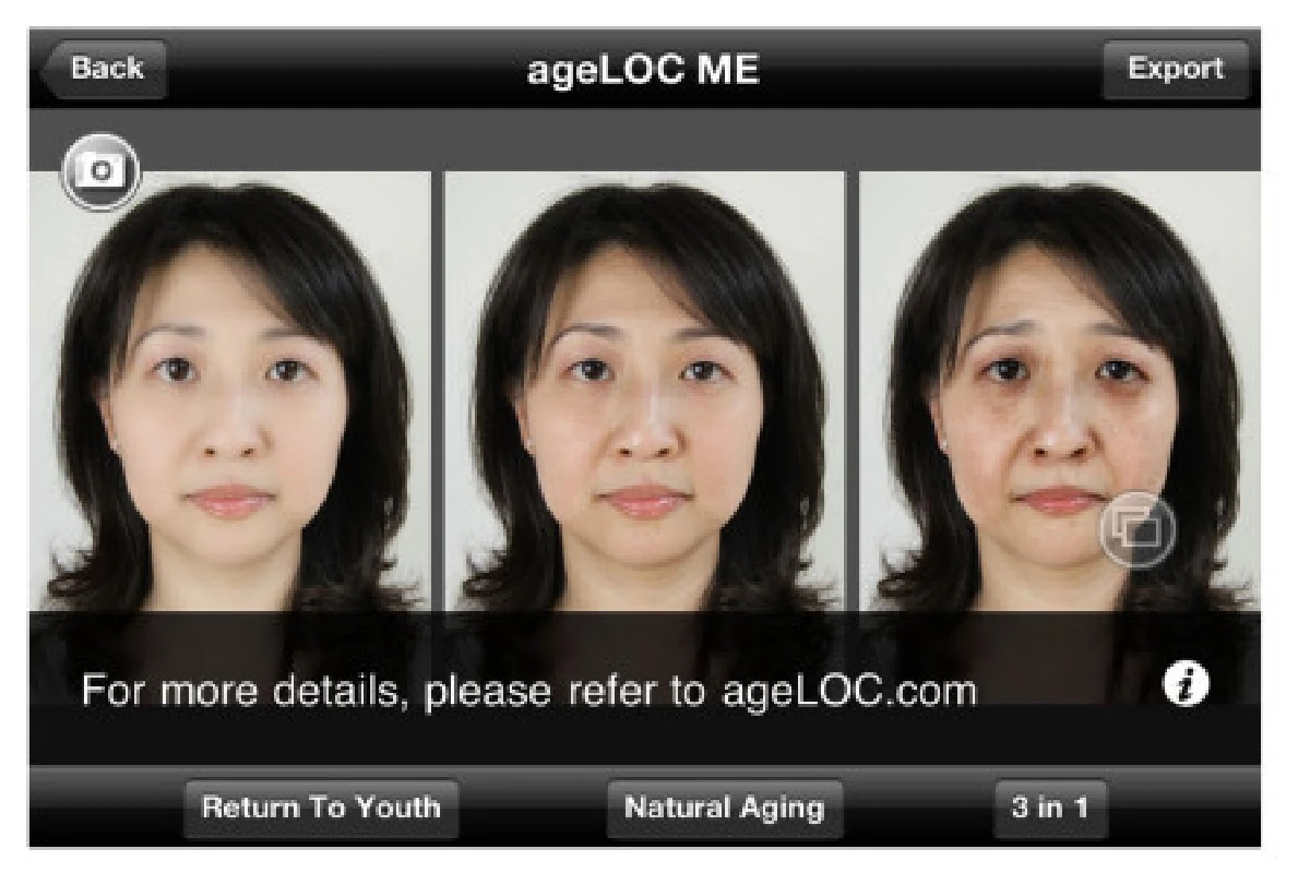 นูสกินผุดแอพฯทำนายอายุผิว