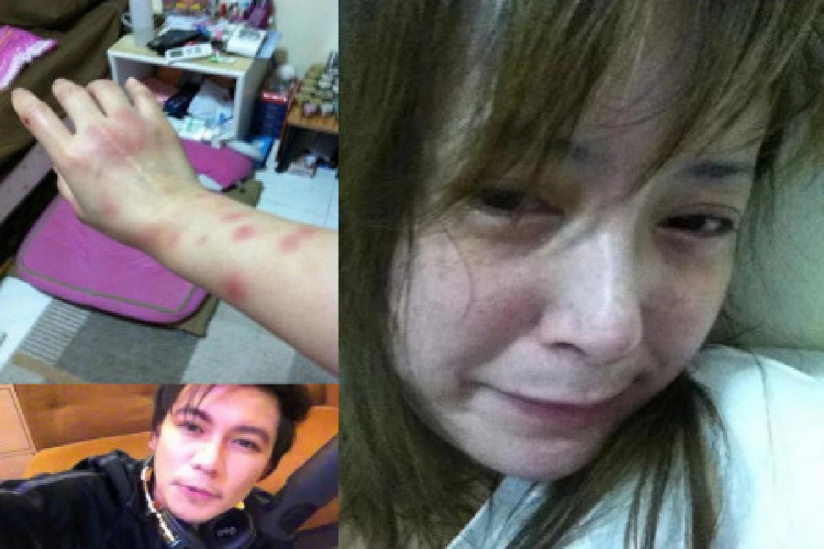 ไนท์ แฉกลับ ต่ายทำร้ายตนเอง