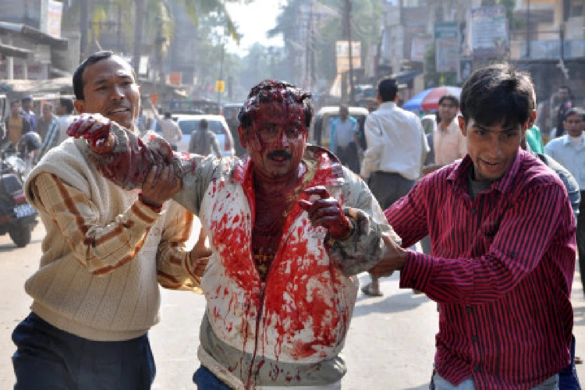 เสือดาวอินเดียตะปบคนสาหัส3