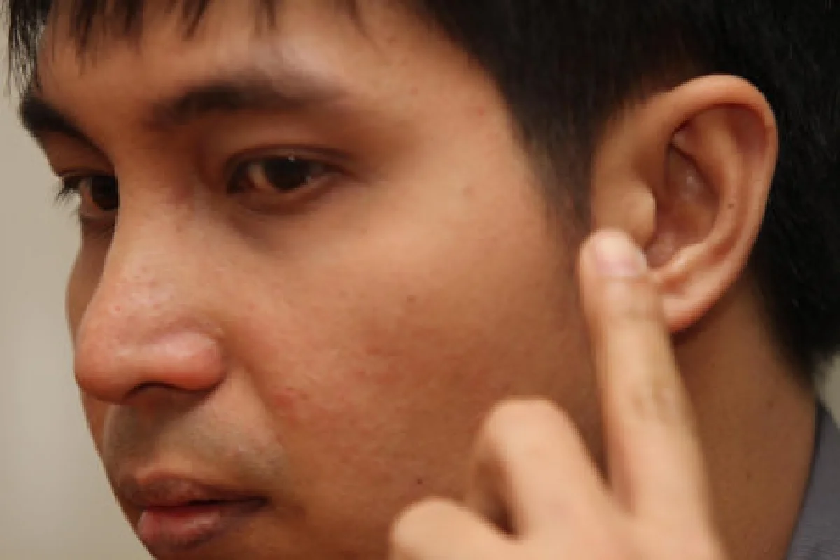 เหยื่อบ้องหูเปิดใจนาทีซี7กร่าง