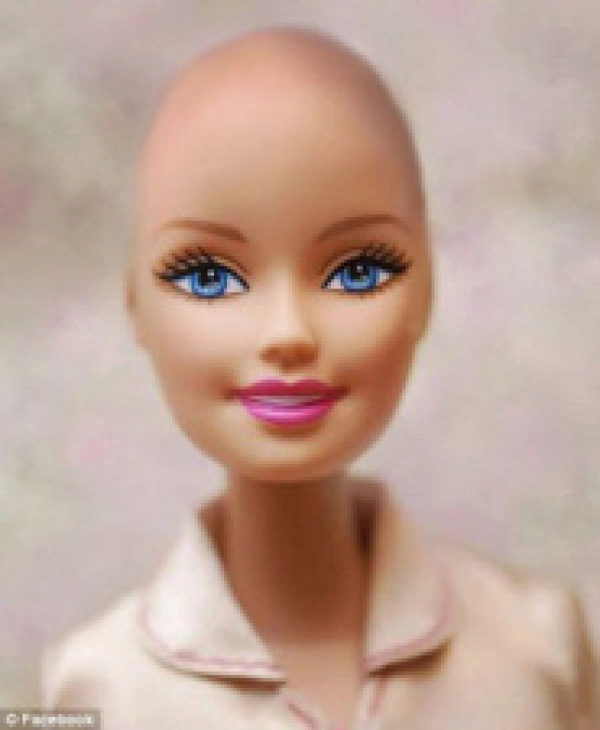 ดันไอเดียบาร์บี้หัวล้านช่วยเด็กสู้มะเร็ง