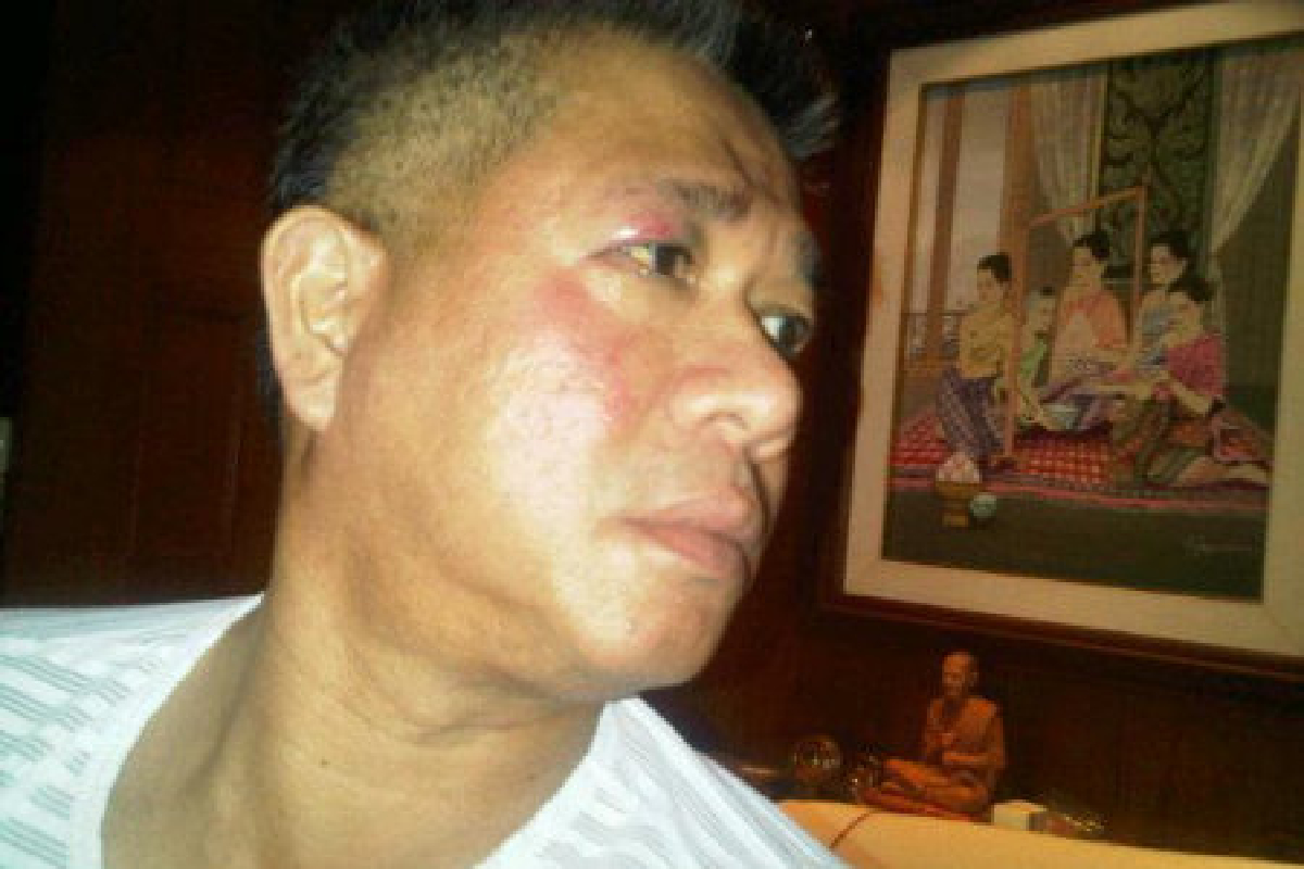 ขู่เอาผิดเอกยุทธไม่แจ้งความโดนชก ขู่เอาผิดเอกยุทธไม่แจ้งความโดนชก