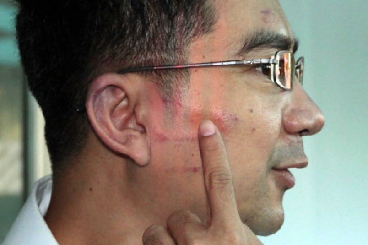 Nitirat leader assaulted, attackers arrested
