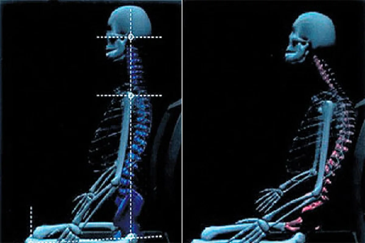 นั่งดูทีวีให้ห่างไกลอัมพฤกษ์