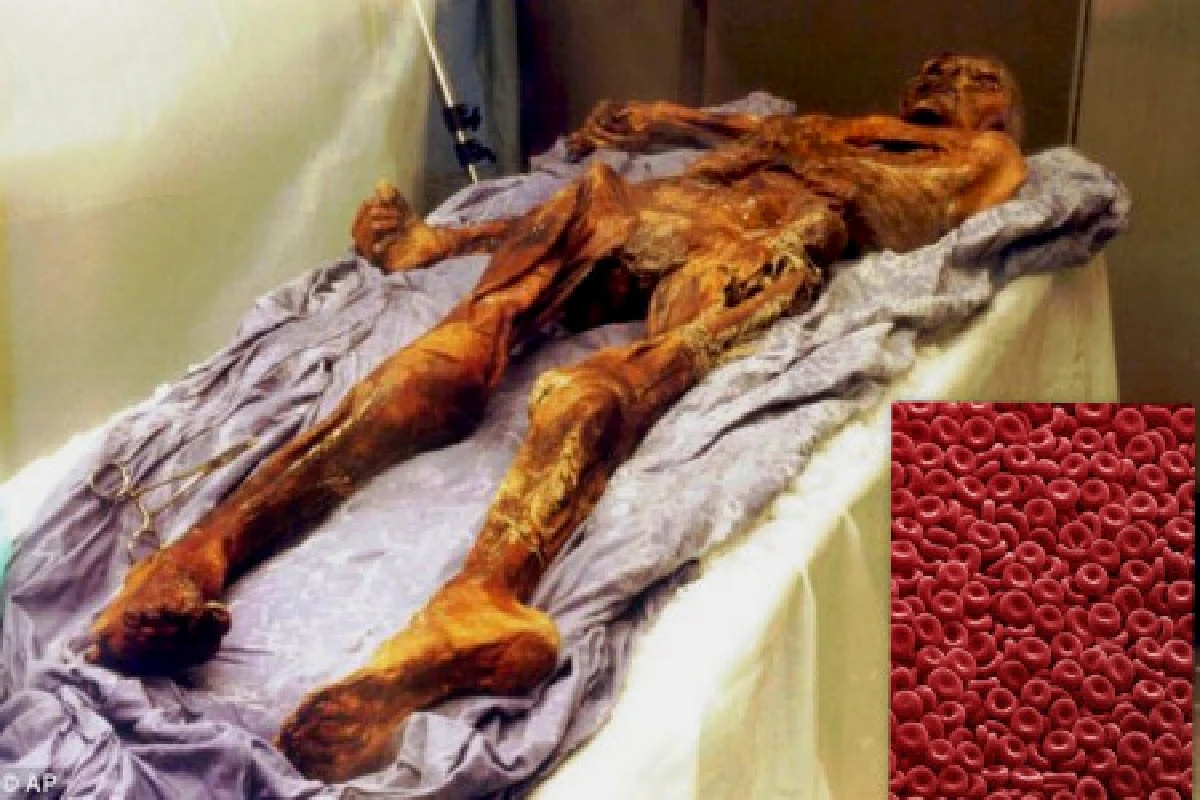 พบเซลล์เม็ดเลือดแดงยุคมนุษย์น้ำแข็ง