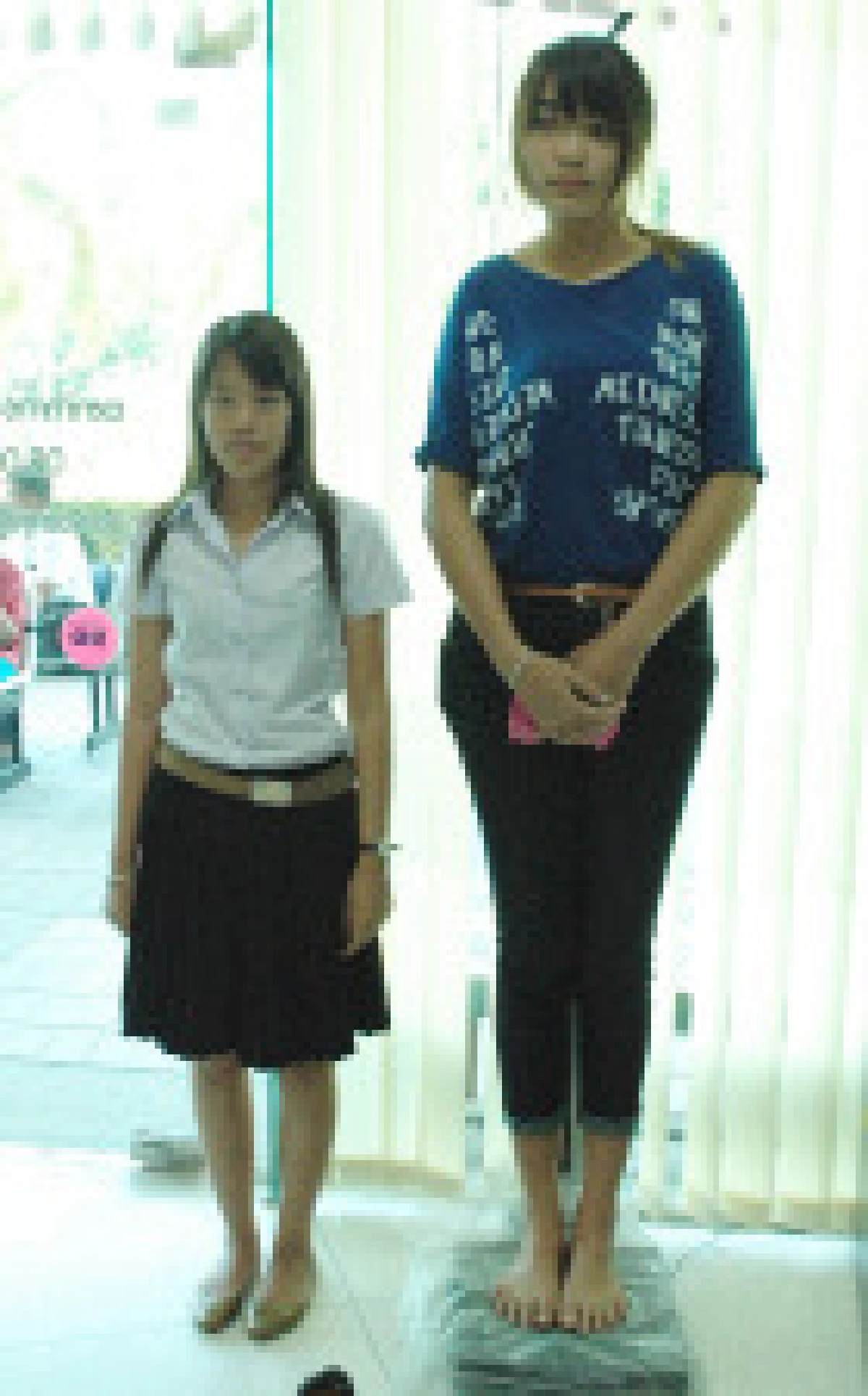 หมอนเรศวรช่วยรักษาสาวร่างสูงผิดปกติ