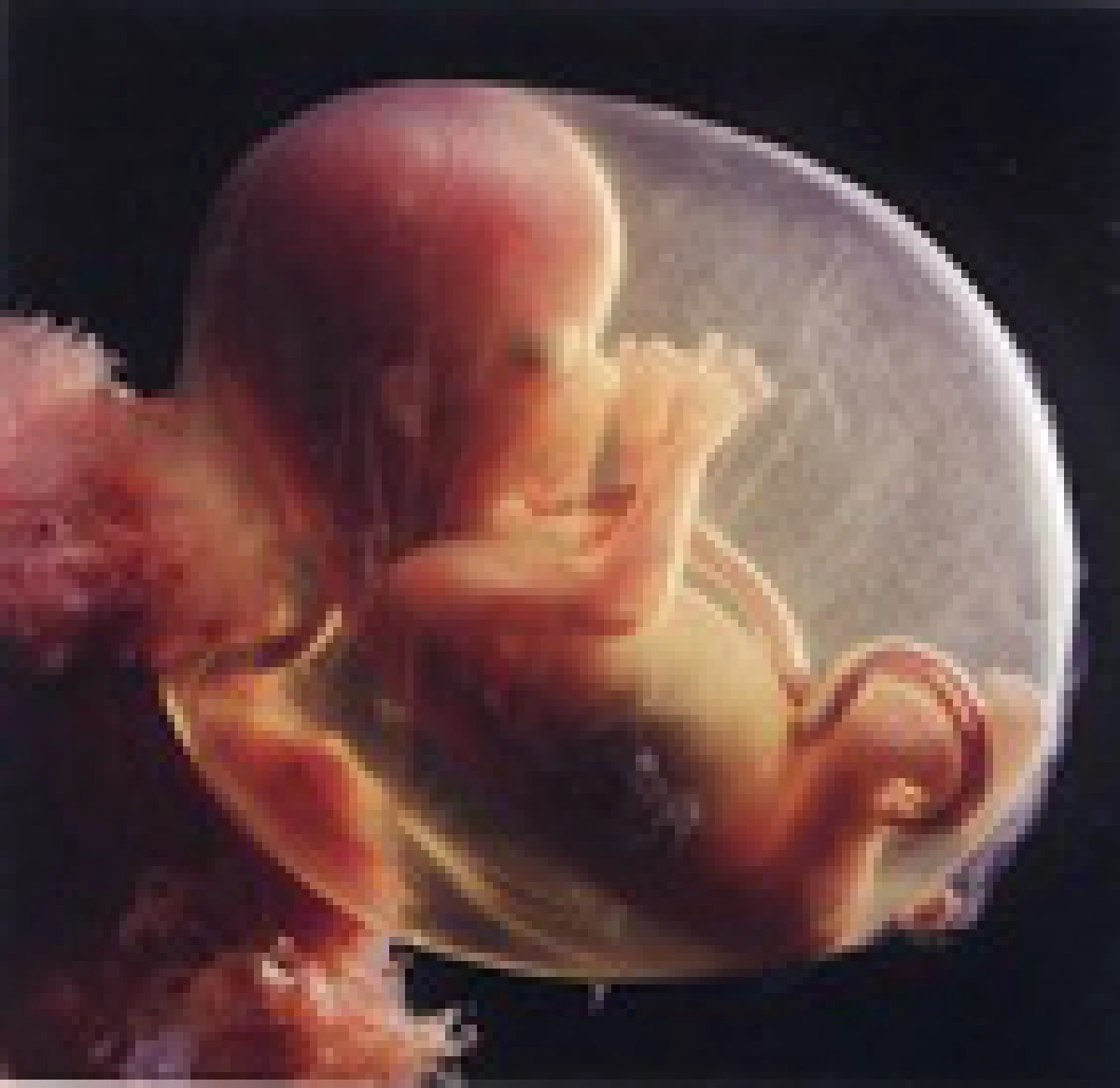 foetus
