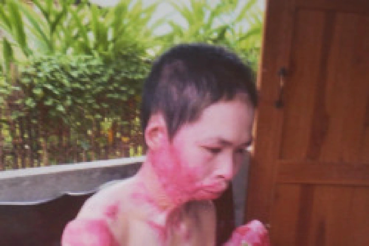 วอนช่วยสาวเจออดีตสามีเผาทั้งเป็น