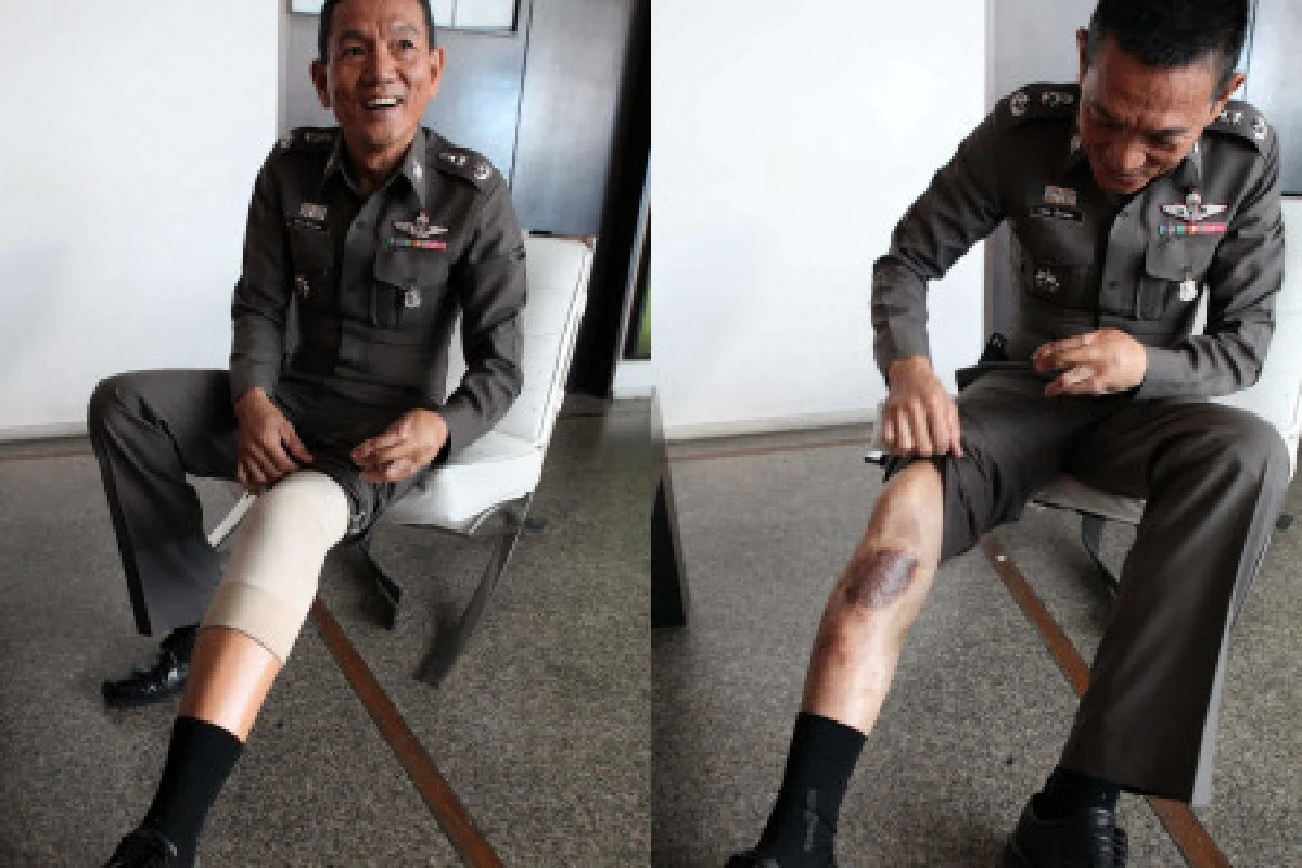 มีวันนี้เพราะประชาชนให้