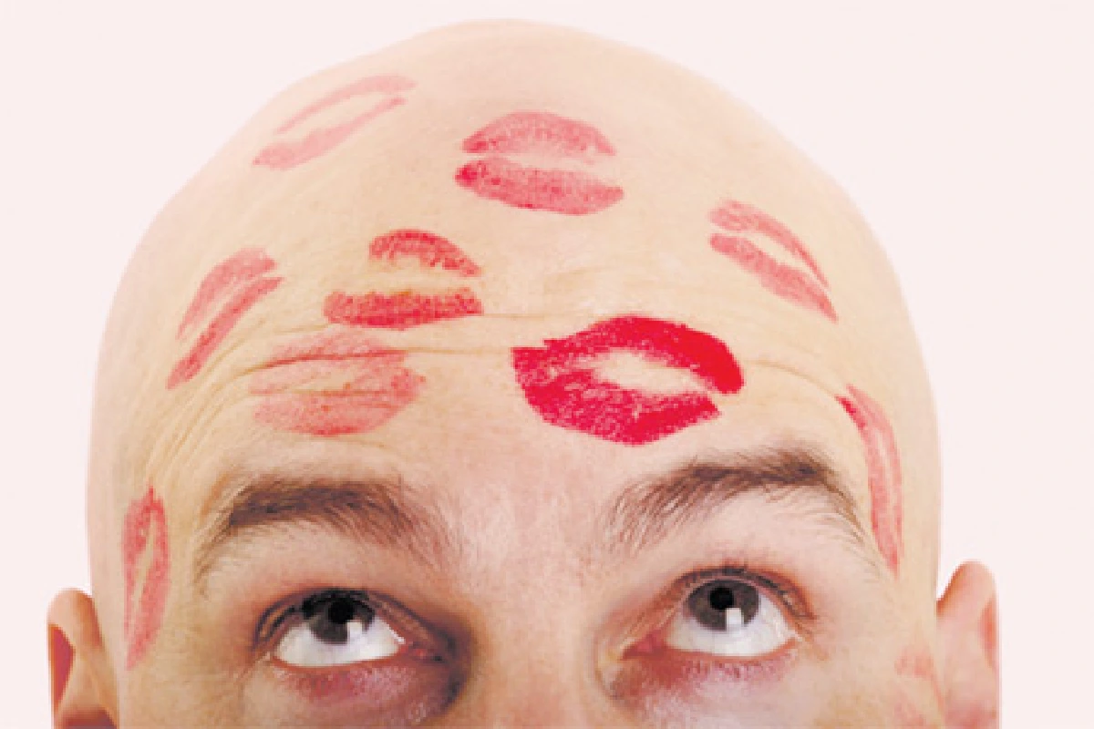 ทรงผมมหาเสน่ห์เทรนด์ "หัวล้าน" คัมแบ็ก