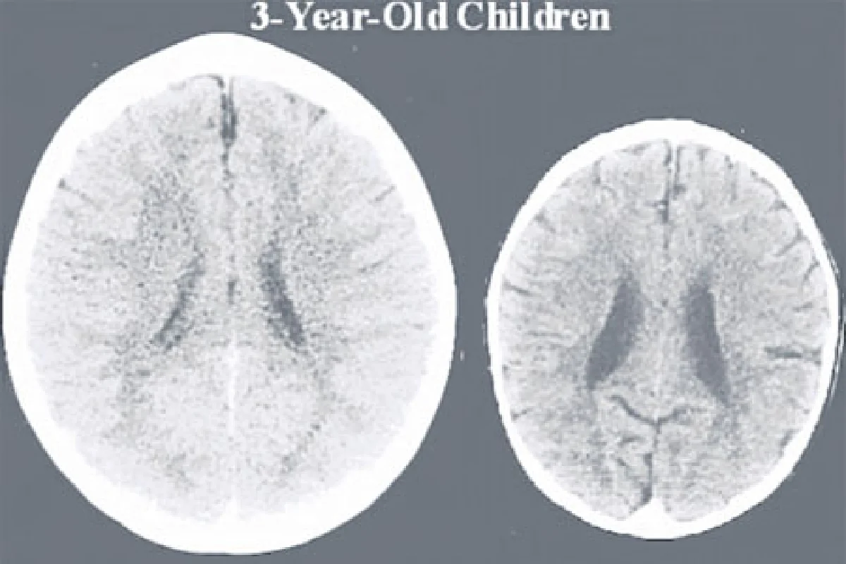 ยิ่งรักลูกสมองเด็กยิ่งพัฒนา