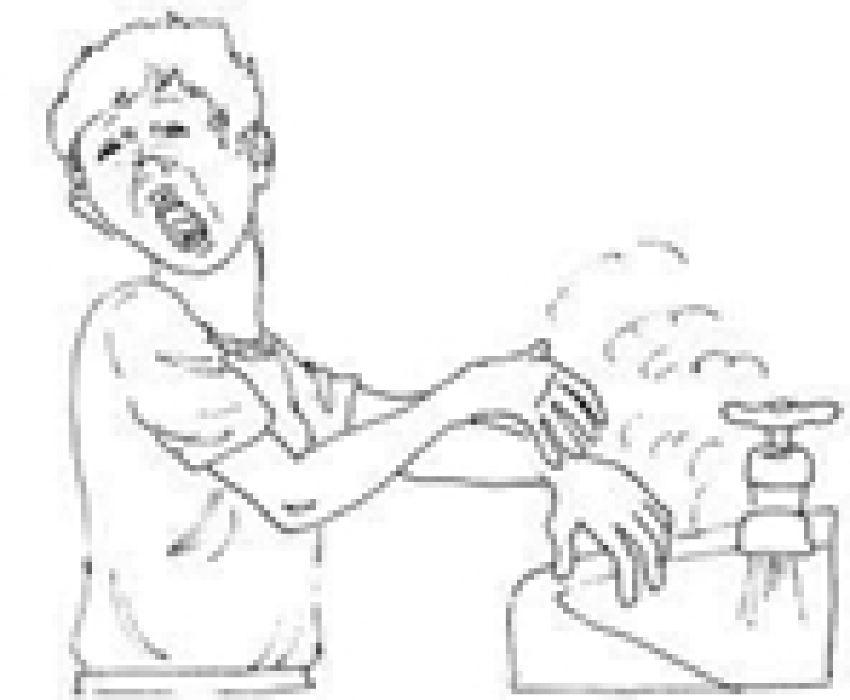 scald