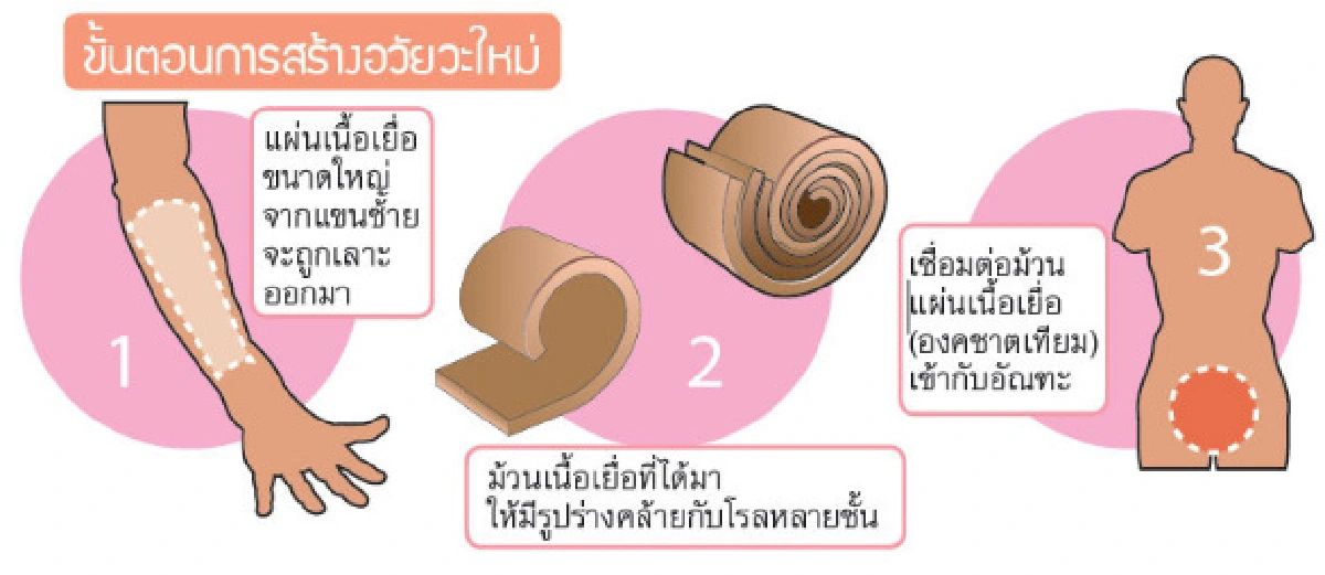 หนุ่มอังกฤษเตรียมเฉือนแขนทำนกเขา