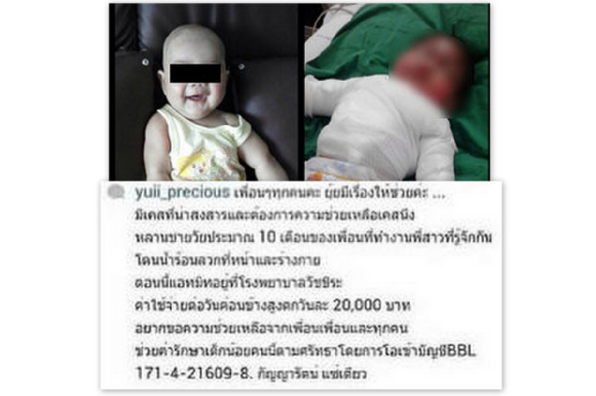 วชิระแจงค่ารักษาน้องออมสินจ่ายจริงแค่1หมื่น วชิระแจงค่ารักษาน้องออมสินจ่ายจริงแค่1หมื่น
