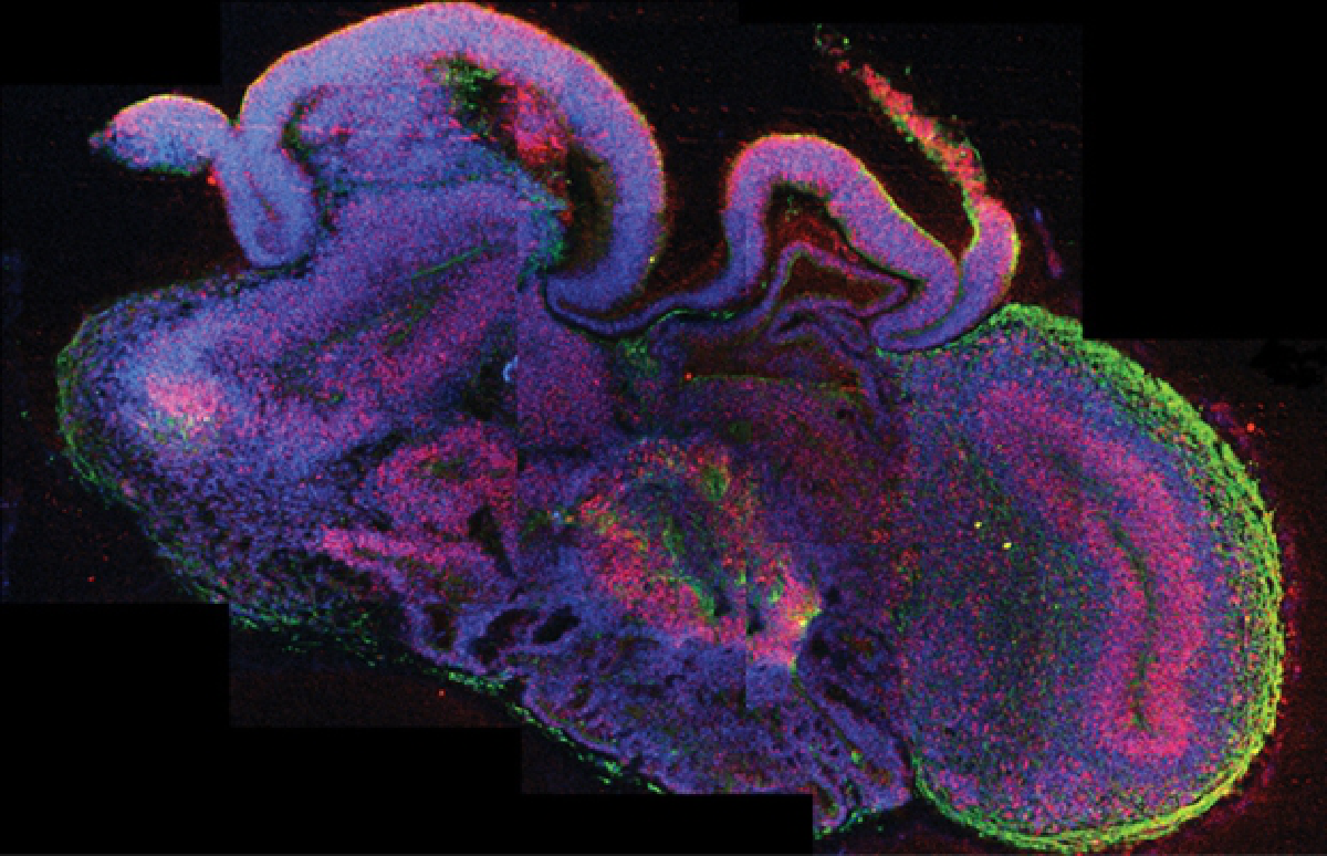 Scientists grow 'mini human brains' from stem cells