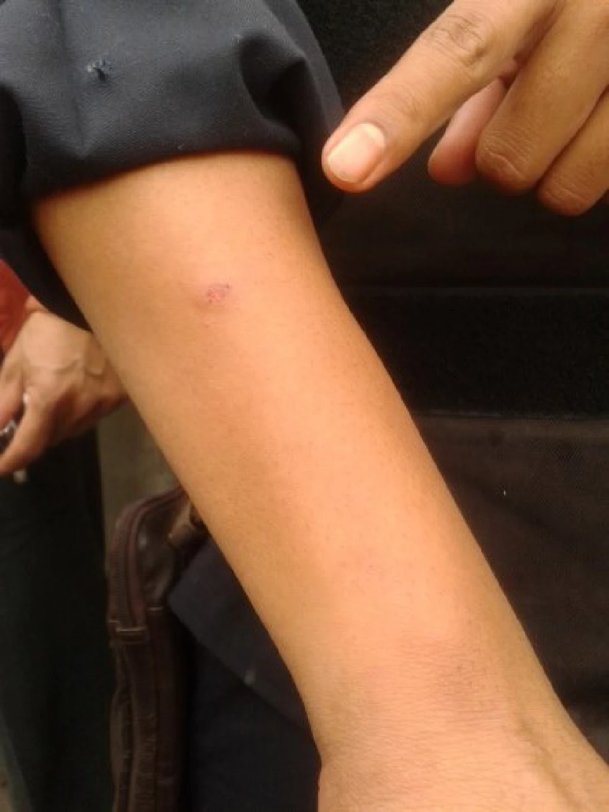 ขว้างประทัดยักษ์ใส่ตำรวจที่มัฆวานเจ็บ1