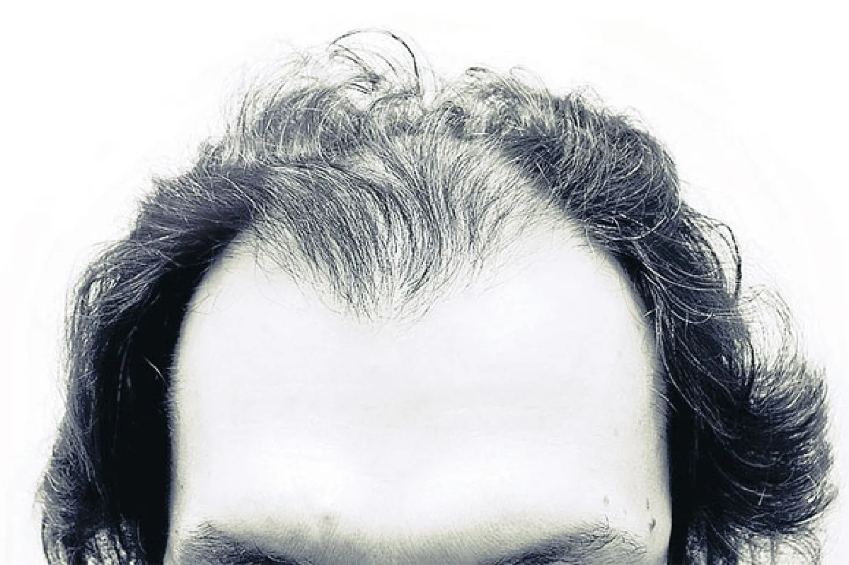 ดูแล ‘(เส้น)ผม’ ตามวัย