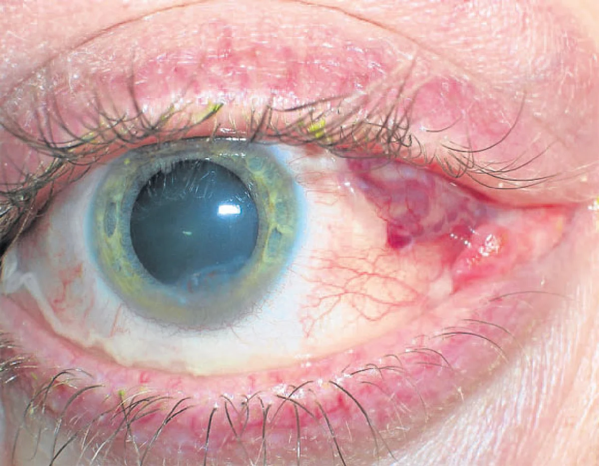 สัญญาณจาก 'ดวงตา'