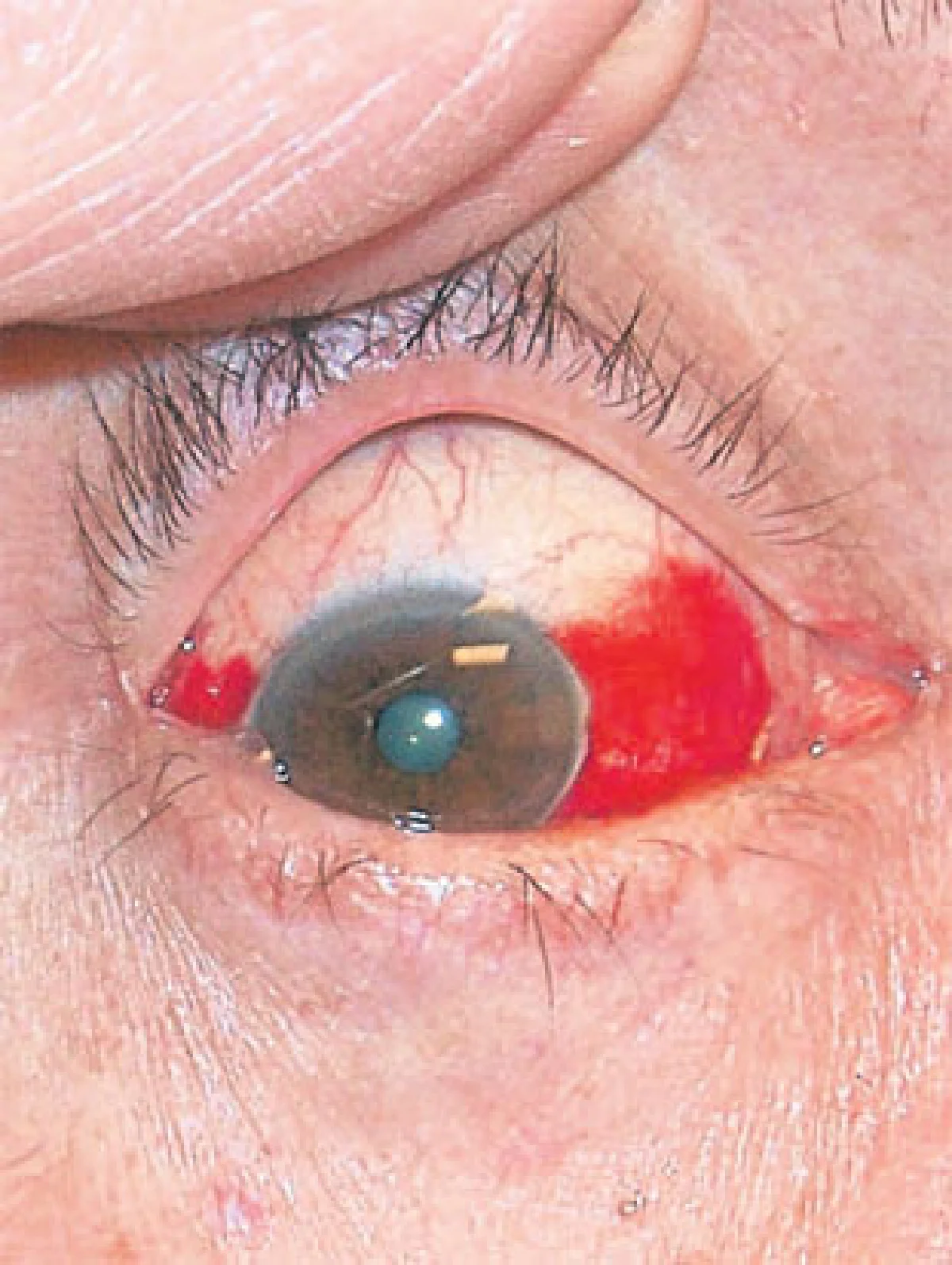 สัญญาณจาก 'ดวงตา'