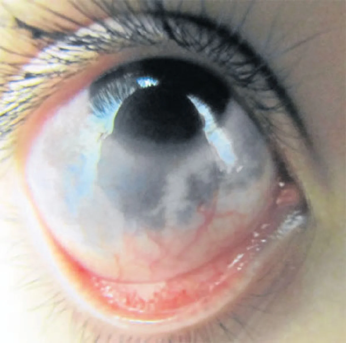 สัญญาณจาก 'ดวงตา'