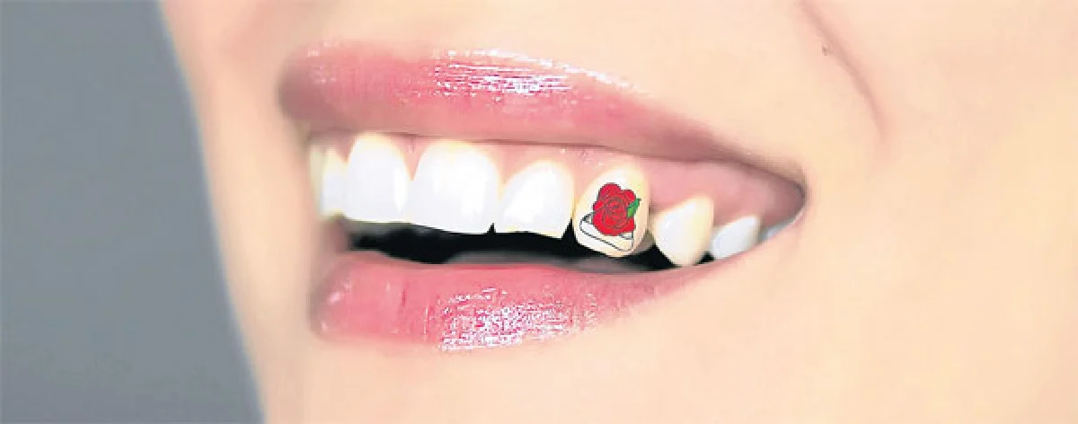 แฟชั่นฮิตสุดแปลกแดนมะกัน ‘สักฟัน’