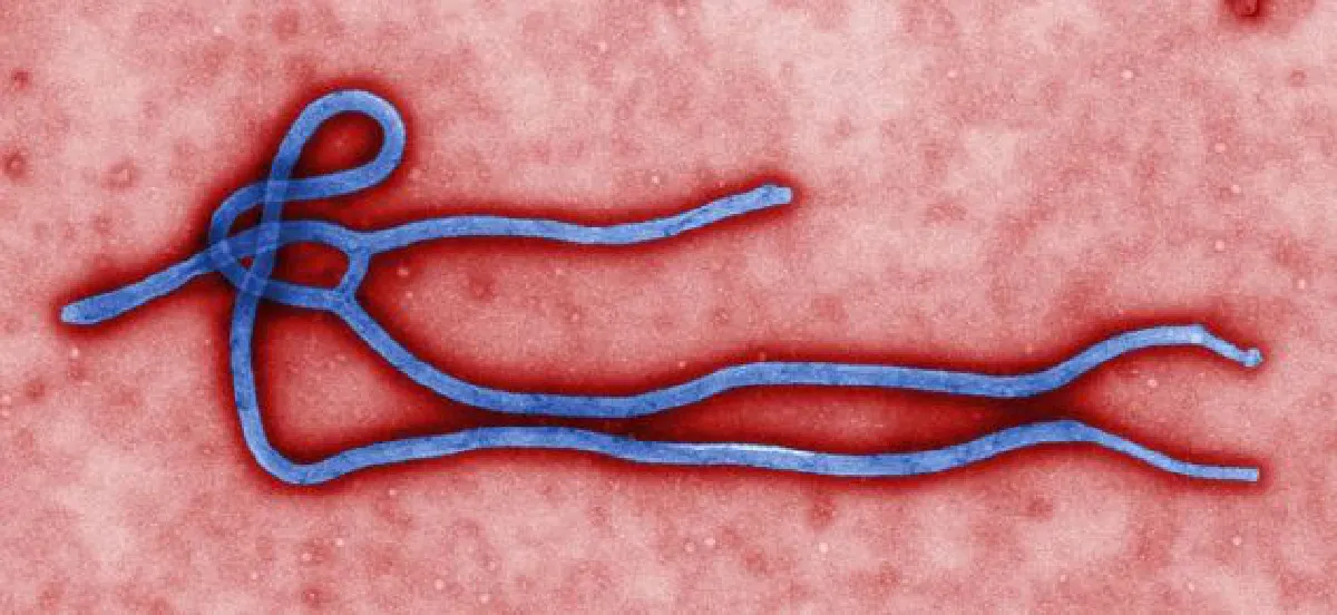 30-minute Ebola test for quick diagnosis