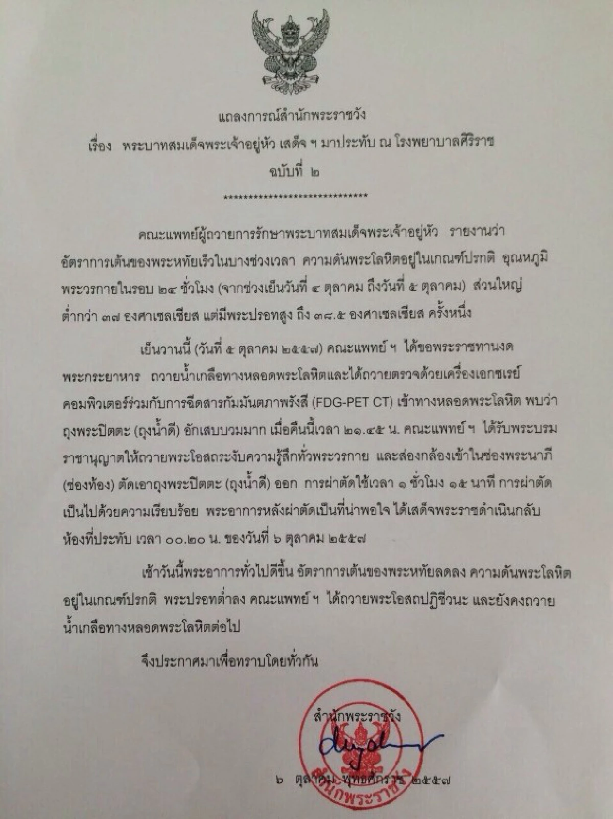ในหลวงถุงน้ำดีอักเสบแพทย์ผ่าตัดพระอาการดีขึ้น
