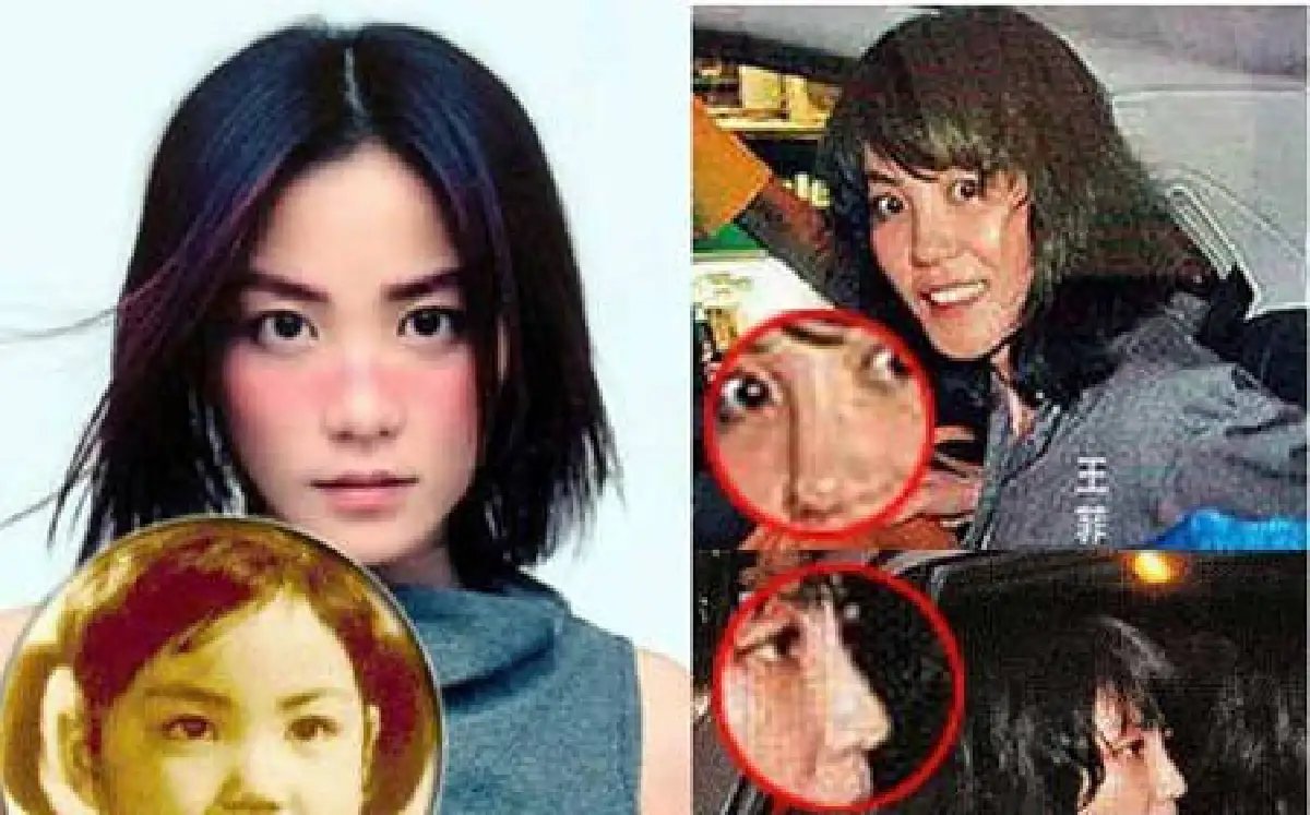 เผยโฉมดาราเอเชียหน้าพังเพราะศัลยกรรม