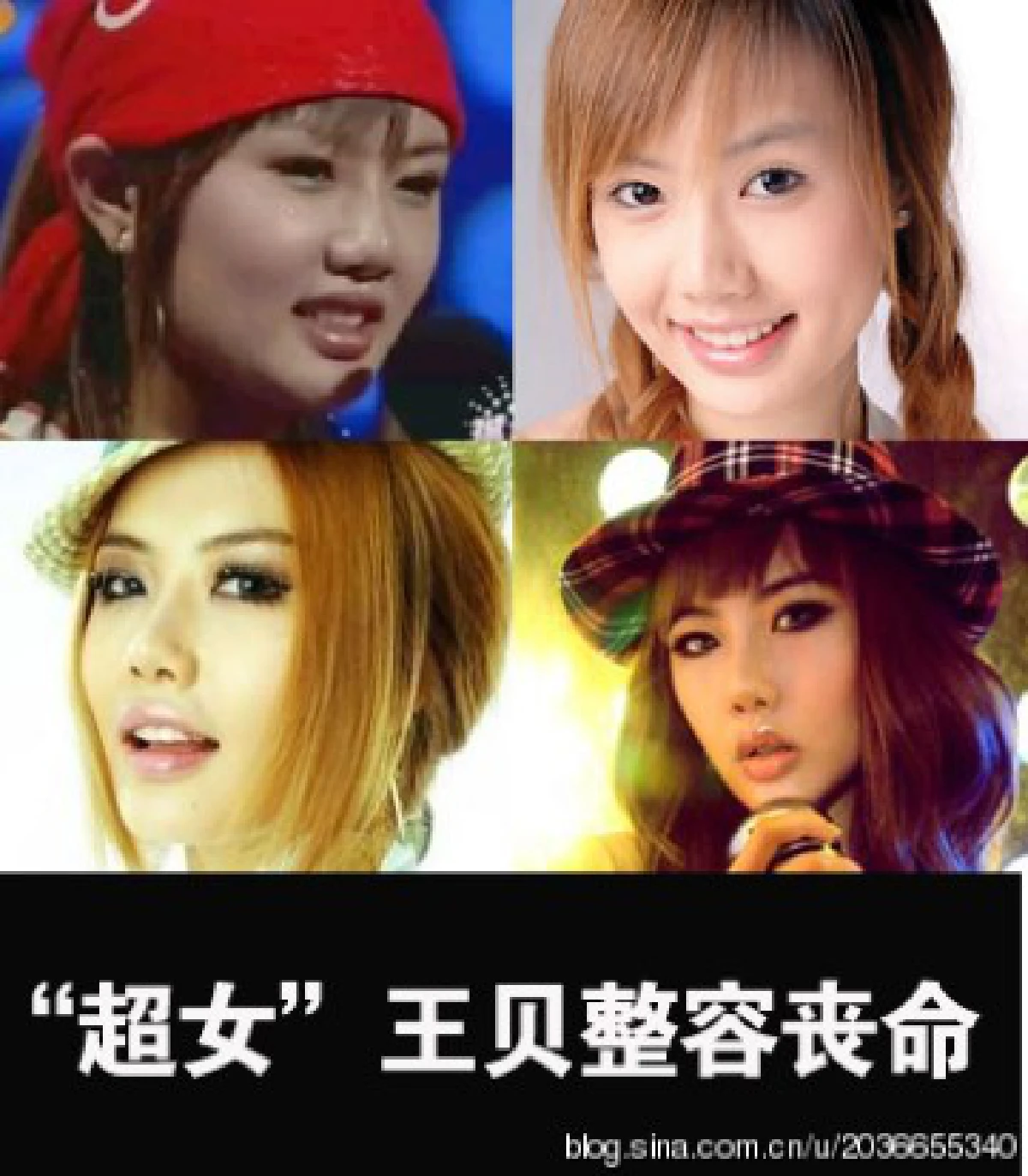 เผยโฉมดาราเอเชียหน้าพังเพราะศัลยกรรม