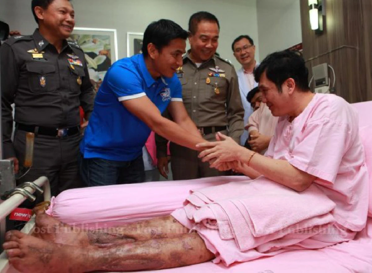 "ซิโก้"เยี่ยมตำรวจเตะระเบิดผบ.ตร.ชวนกลับรับราชการ