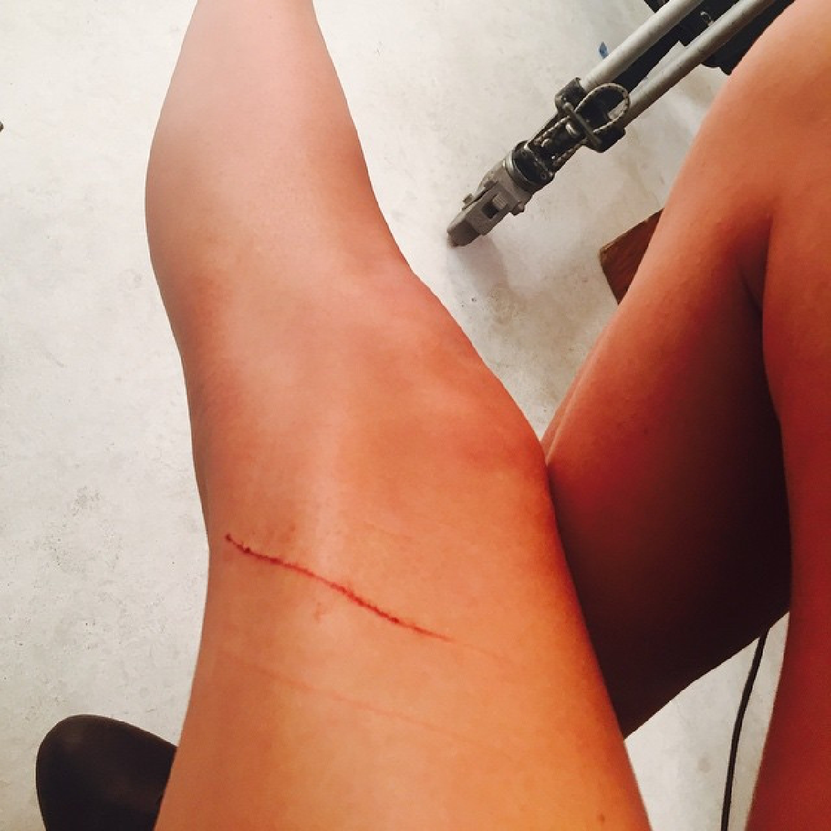 "เทย์เลอร์"โดนแมวข่วนขา!หลังทำประกันไว้พันล้าน