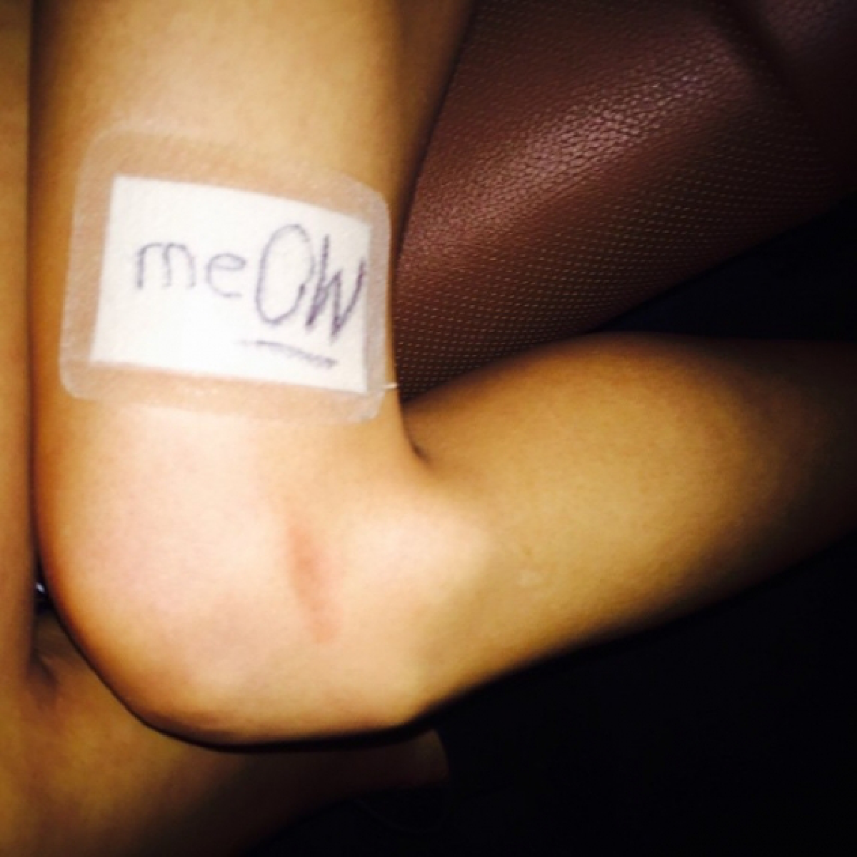 "เทย์เลอร์"โดนแมวข่วนขา!หลังทำประกันไว้พันล้าน