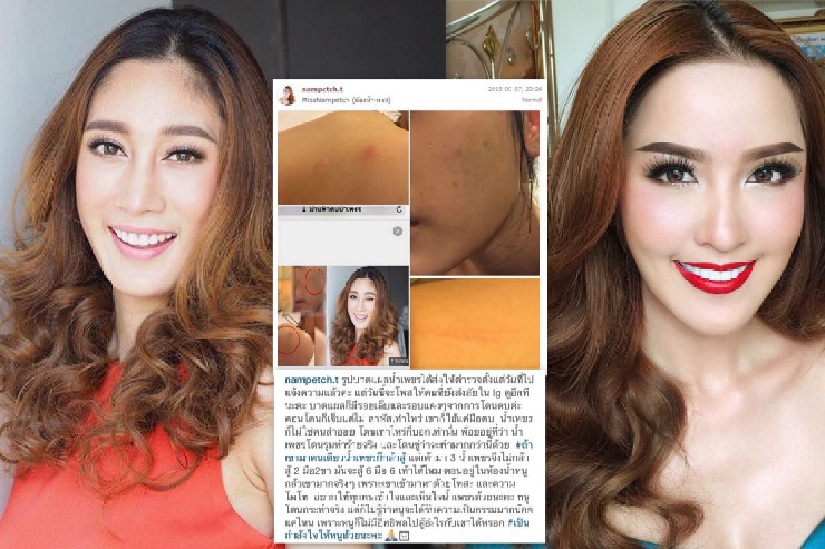 ถ้ามาคนเดียวก็กล้าสู้! น้ำเพชร โชว์รอยแผลถูกตบจริงไม่มโน ถ้ามาคนเดียวก็กล้าสู้! น้ำเพชร โชว์รอยแผลถูกตบจริงไม่มโน
