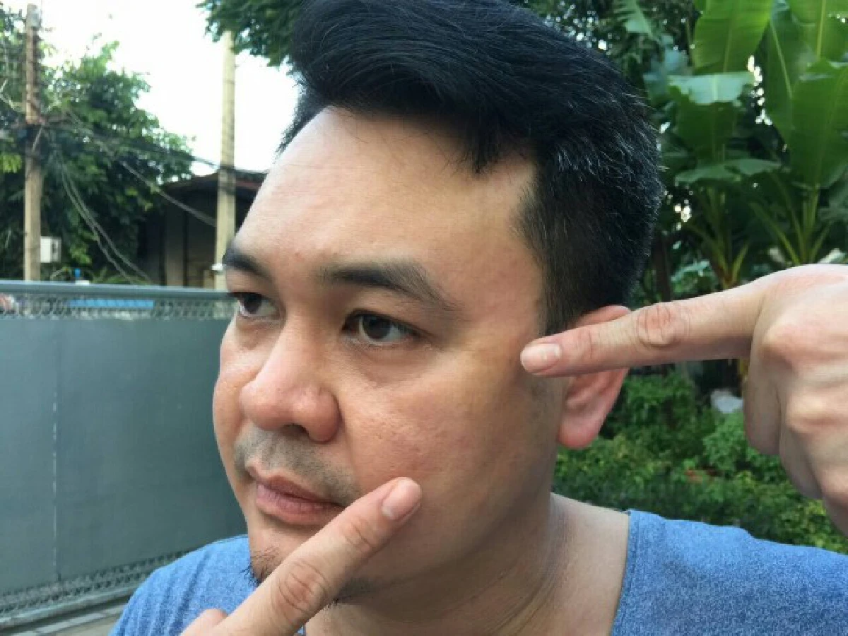 "เป๊ก สัณชัย" ตบหน้าแพทย์นิติเวชกลางงานแต่ง