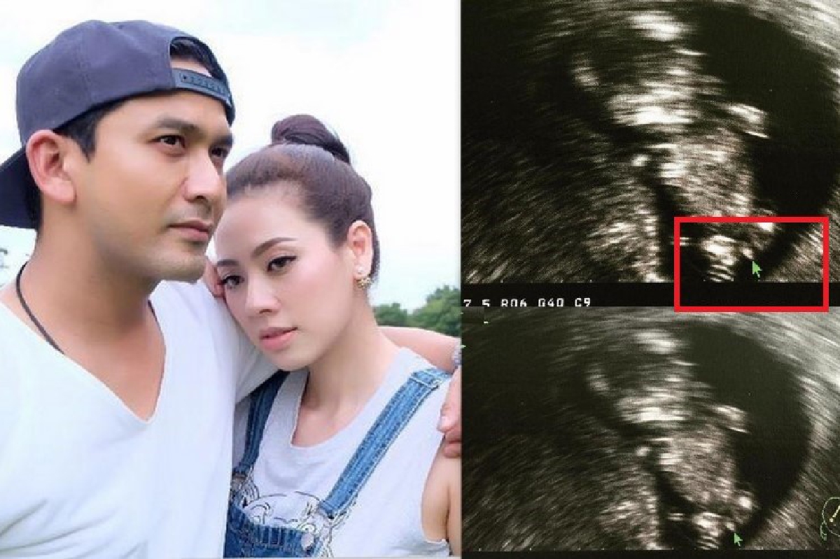 ป๋อ เผยภาพอัลตร้าซาวด์ลูกคนที่2 บอกให้สังเกตเพศที่ลูกศร? ป๋อ เผยภาพอัลตร้าซาวด์ลูกคนที่2 บอกให้สังเกตเพศที่ลูกศร?