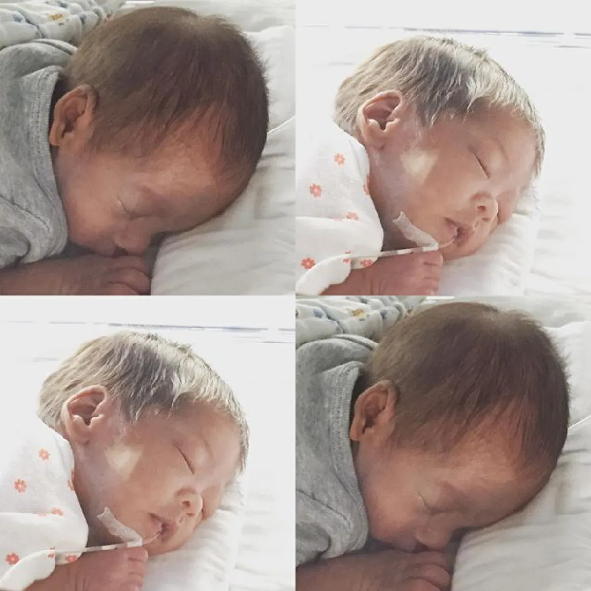 หมอโอ๊ค-โอปอล์ แอบห่วง! น้องอลิน ลิ้นหัวใจผิดปกติ