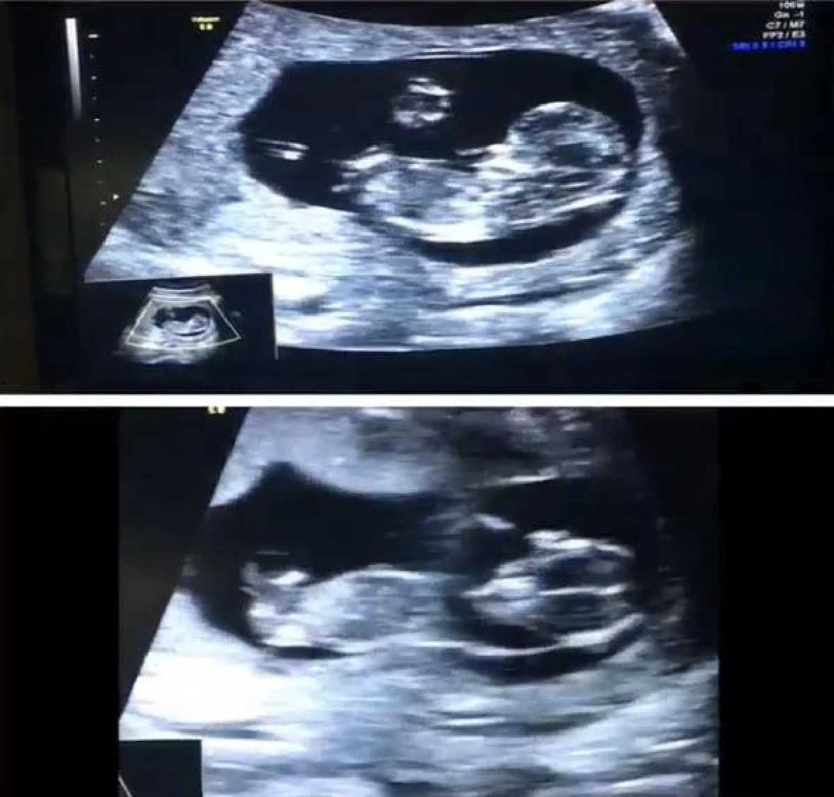 กระแต ศุภักษร ได้ฤกษ์เผยข่าวดี ตั้งท้อง 3 เดือนแล้ว!!