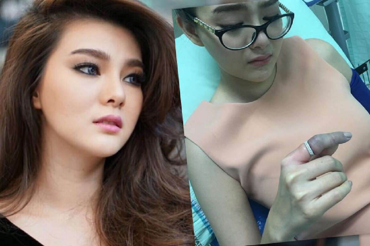 ดิว อริสรา ถูกส่งโรงพยาบาลด่วน แหวนรัดนิ้วบวมเป่ง!! ดิว อริสรา ถูกส่งโรงพยาบาลด่วน แหวนรัดนิ้วบวมเป่ง!!