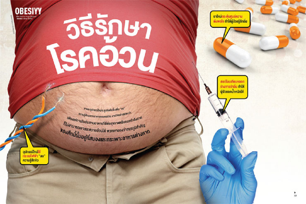 วิธีรักษาโรคอ้วน วิธีรักษาโรคอ้วน