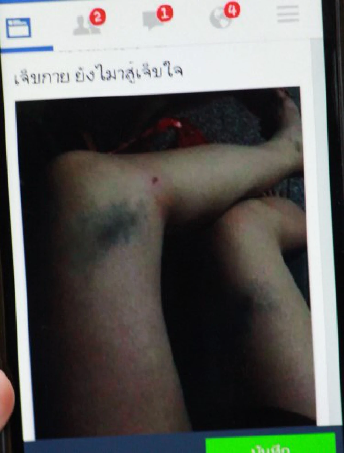 "ผัวซ้อมเมีย"...ใครว่าสังคมไม่เกี่ยว?