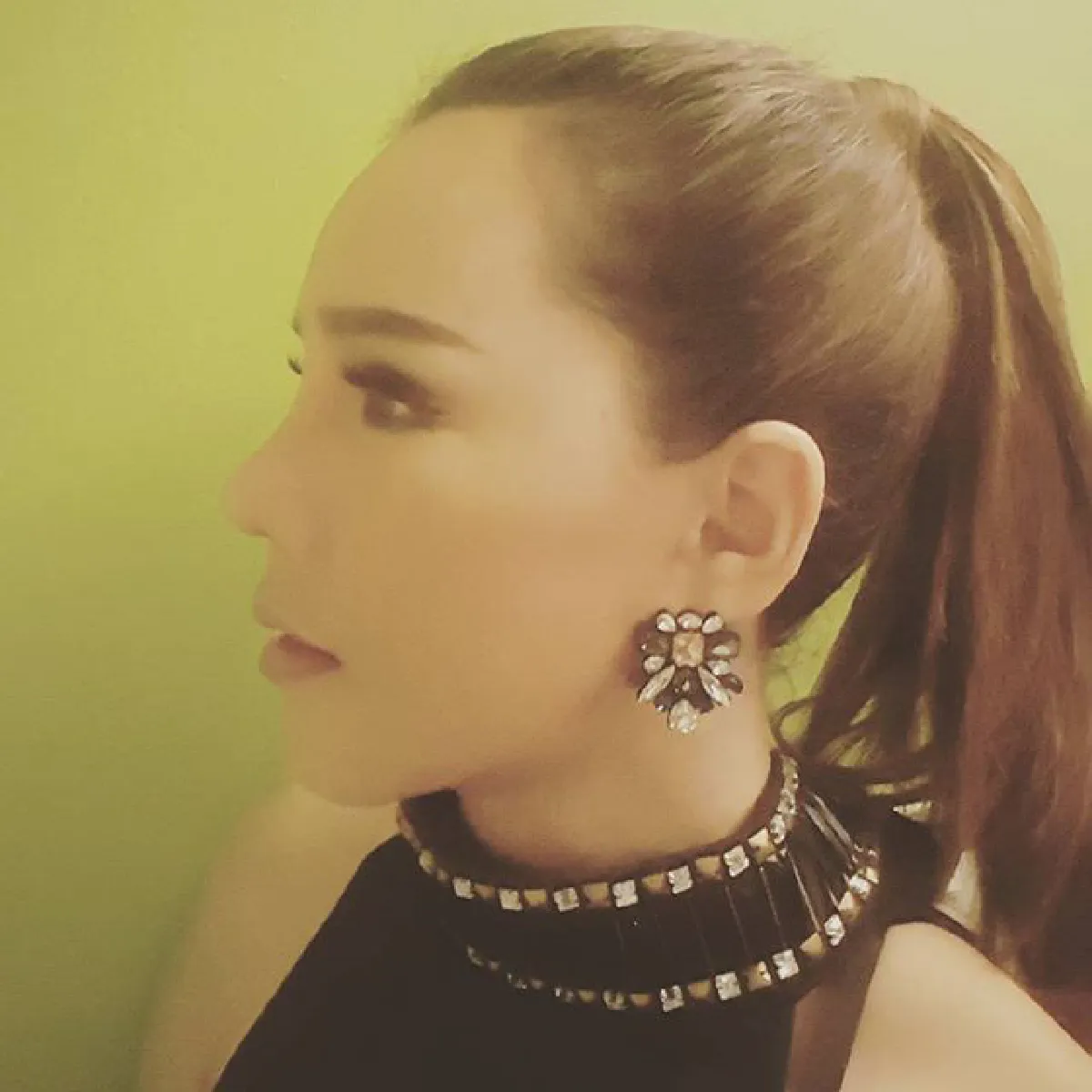 สวยขึ้นเป็นกอง! ส้มเช้ง สามช่า ศัลยกรรมอัพหน้าที่เกาหลี