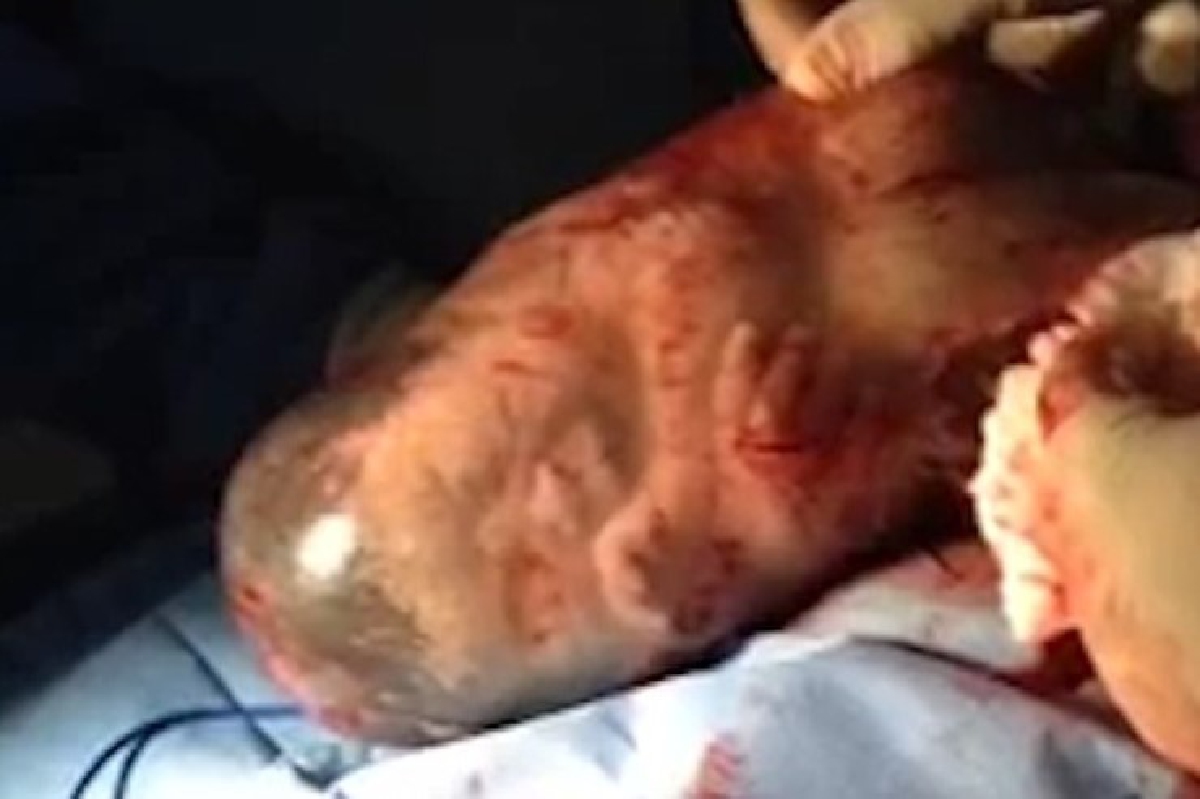 หาดูยาก!ชมคลิปทารกอ้าปากหาวในถุงน้ำคร่ำหลังคลอด หาดูยาก!ชมคลิปทารกอ้าปากหาวในถุงน้ำคร่ำหลังคลอด