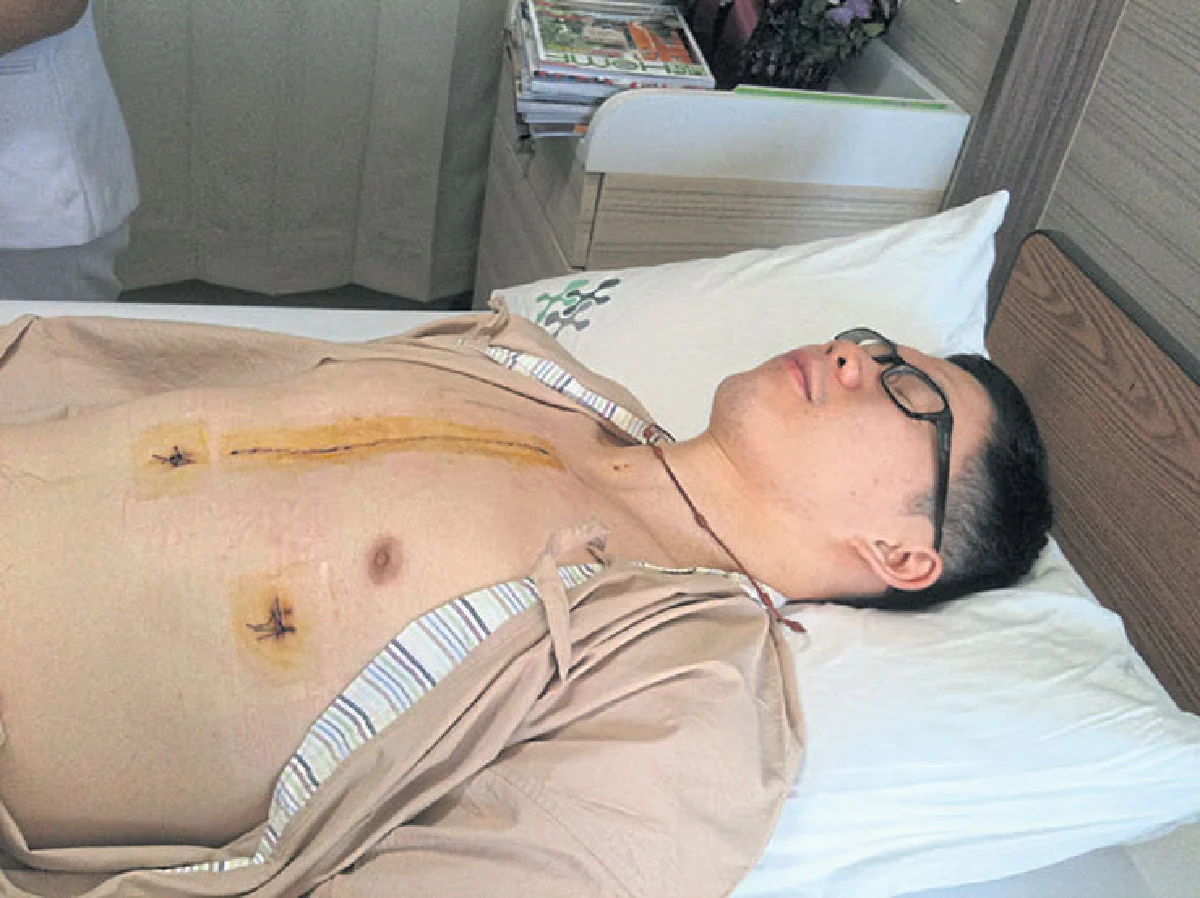 ชญาน์ทัต วงศ์มณี ลืมไม่ได้กับการผ่าหัวใจแบบฉับพลัน ไม่ทันตั้งตัว