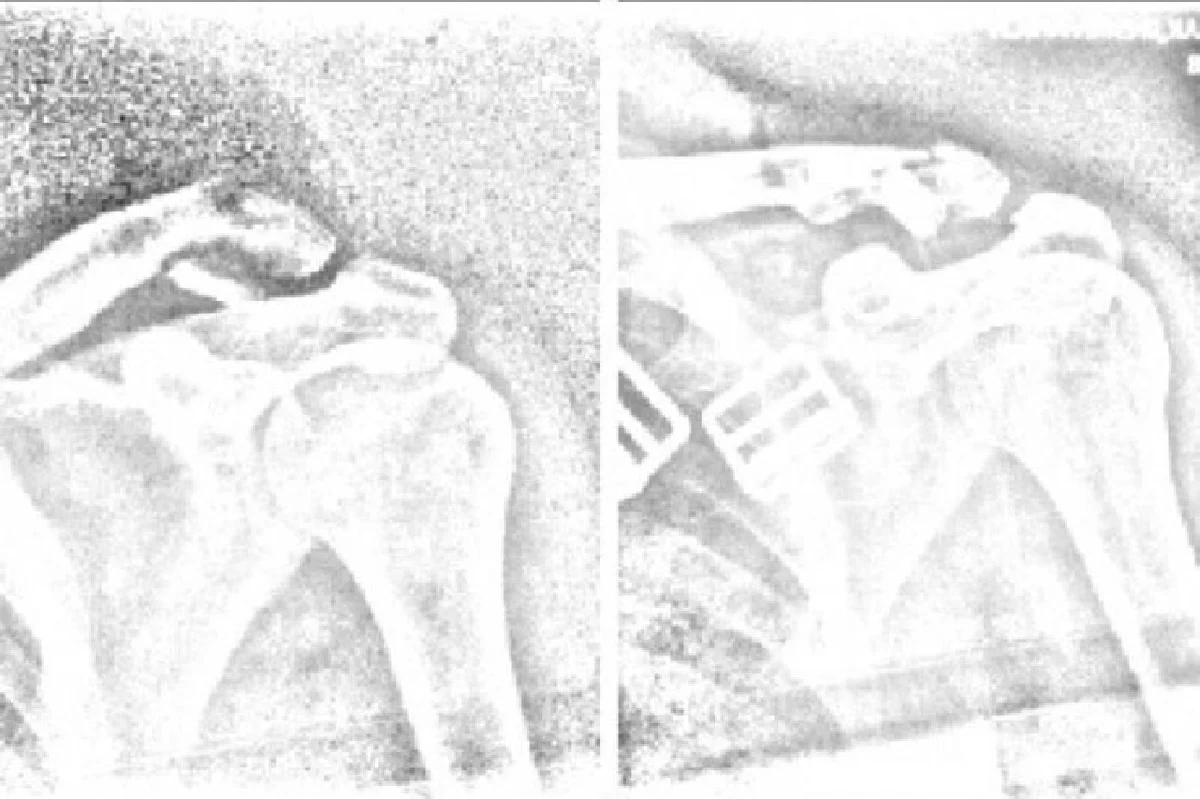 ชีวิตบททดสอบยากๆ และพรุ่งนี้อาจจะไม่เหมือนเดิม